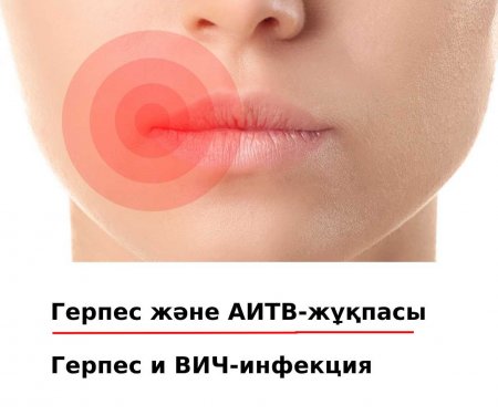 Герпес және АИТВ-жұқпасы