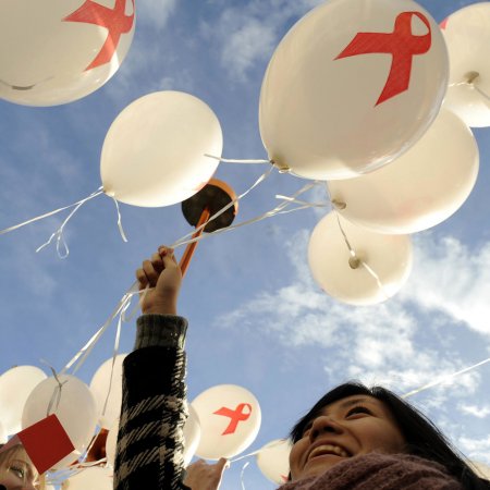  АИТВ мен ЖИТС арасындағы айырмашылық неде?