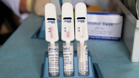 Сілекей үлгісі бойынша жедел тест