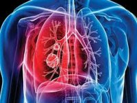 АИТВ жұқтырған адамдардың жағдайы мен өмір сүру деңгейіне туберкулез негізгі оппортунистік инфекция ретінде ерекше қауіп төндіреді