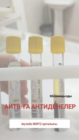 АИТВ-ға антиденелер
