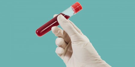 Менің тестім оң нәтиже берді.