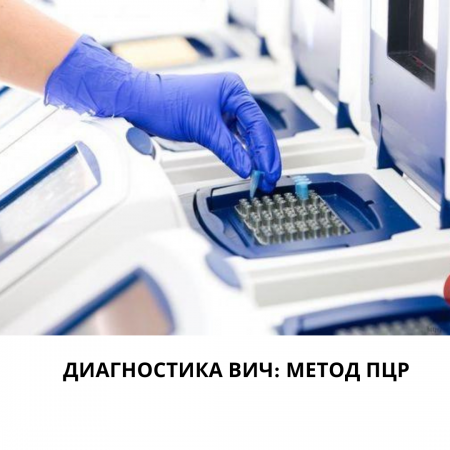 АИТВ-ны диагностикалауға арналған ПТР әдісі.
